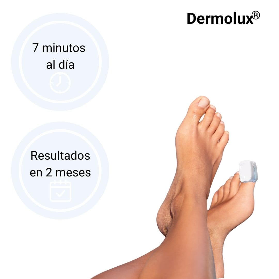 Lampara Laser De Uñas Elimina Hongos