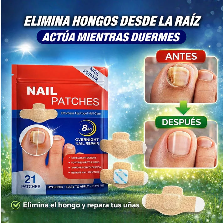 PARCHES ANTIHONGOS PARA UÑAS