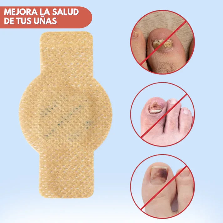 PARCHES ANTIHONGOS PARA UÑAS